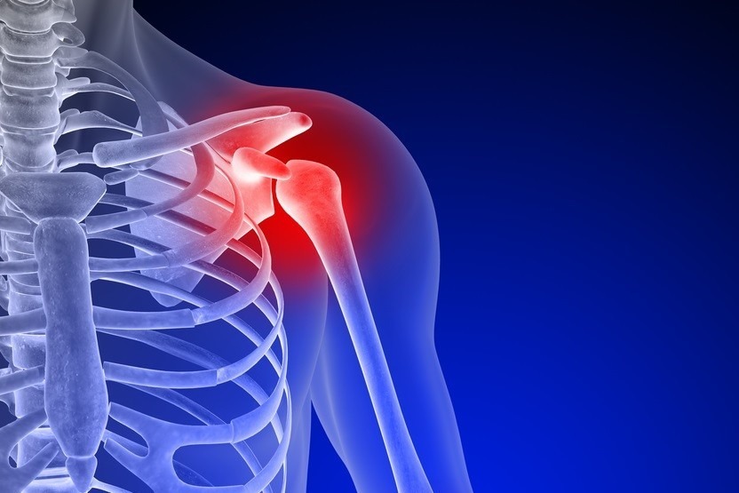 Артроз плечевого сустава: симптомы, степени и лечение1