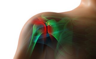 Артроз плечевого сустава: симптомы, степени и лечение
