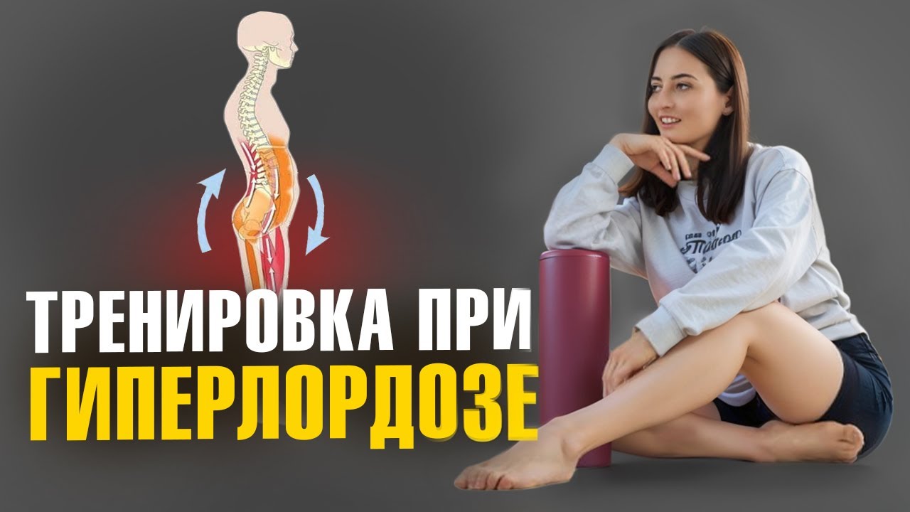 Упражнения от ГИПЕРЛОРДОЗА | Передний наклон таза, боль в пояснице и нижний перекрестный синдром0